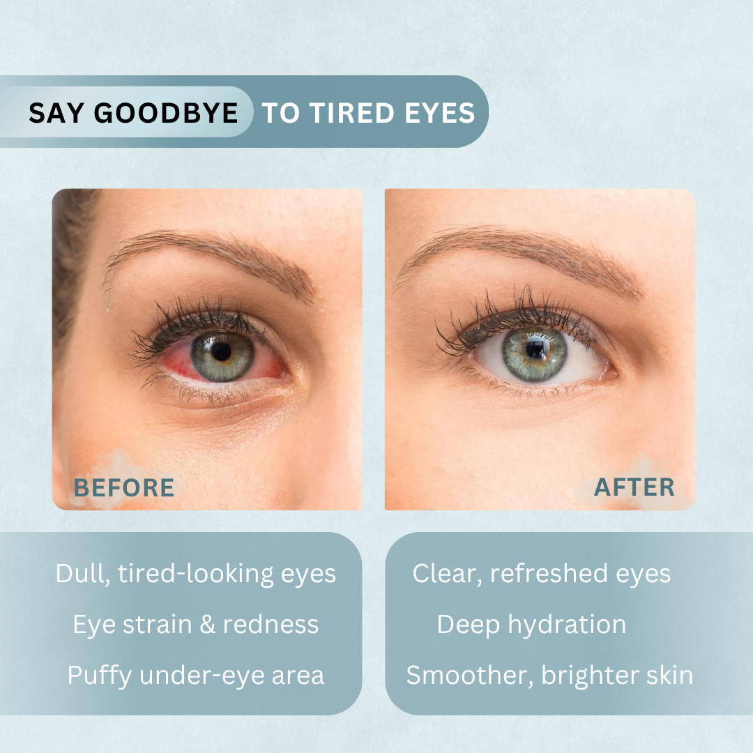FreshEyes Steamer